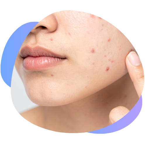 Problemas comunes de la piel